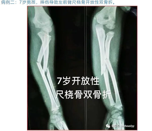 QQ截图20200430101535_副本.png QQ截图20200430101535_副本.png