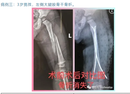 QQ截图20200430101634_副本.png QQ截图20200430101634_副本.png