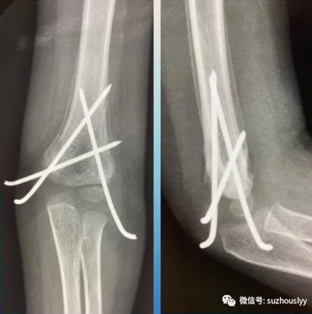 QQ截图20200707101127_副本.png QQ截图20200707101127_副本.png